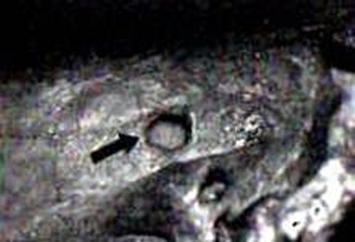Prehistoric skull with bullet