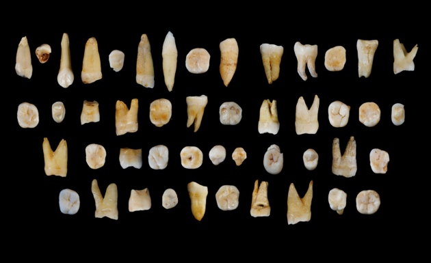 These 47 human teeth, dated to 80,000-120,000 years ago, were found in a limestone cave system in Daoxian, China. S. Xing and X-J. Wu