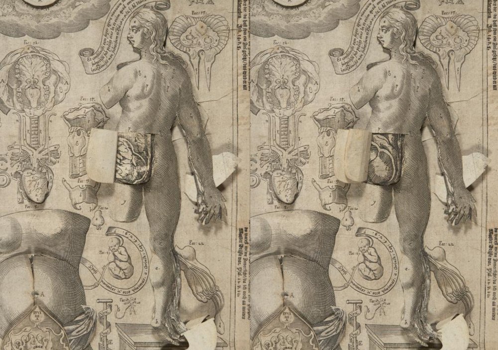 Anatomical flap book – an early attempt to represent the three dimensionality of the human body in the two dimensional format of the book. Credits: Columbia University Libraries’ Conservation Laboratory.