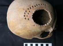 ancient cranial surgery in Peru