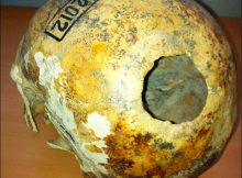 Ancient skull showing clear evidence of recovery after trepanation. Man scull from Kyzyl-Dzhar-V. Photo credits: Institute of Archaeology and Ethnografy of the Siberian Branch of Russian Academy of Sciences