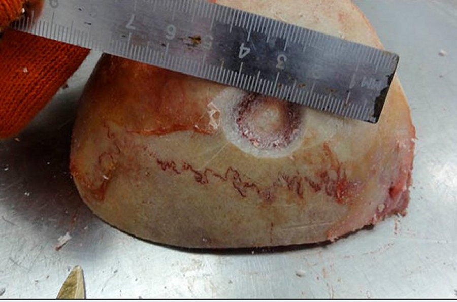 Modern scull after the 'surgery' conducted by Alexei Krivoshapkin copying ancient techniques. Picture: Alexei Krivoshapkin