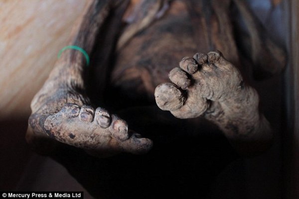 Fire mummies