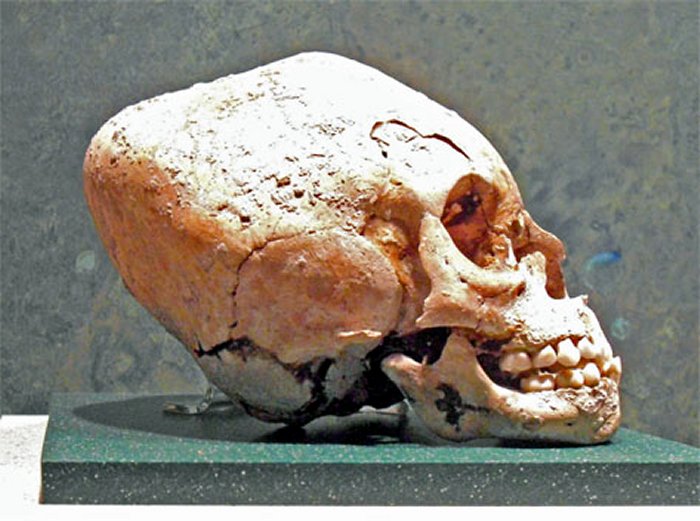 Ancient elongated Inca skull.