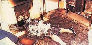 Unexplained Phenomenon Of Spontaneous Human Combustion