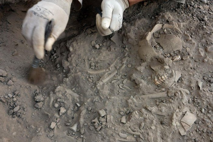 sudan skull trepanation