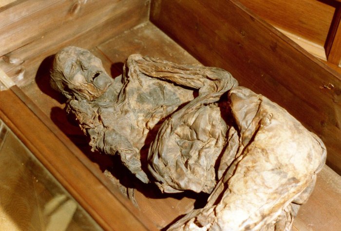 Unsolved Mystery Of The Huldremose Woman: One Of The Best Preserved Bog Bodies Ever Found