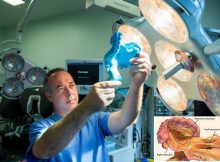 New organ - the mesentery - discovered in human body