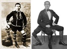 Francesco Lentini: The Three-Legged Wonder Man With Four Feet And 16 Toes Who Became A Celebrity