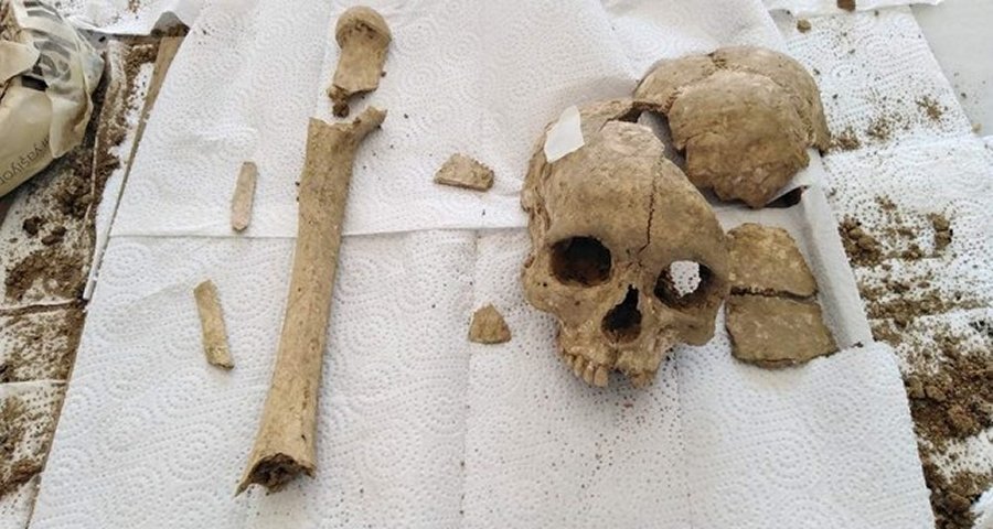 3,500-Year-Old Skull And Thighbone Discovered In Sapinuwa Antique City Of Central Anatolia
