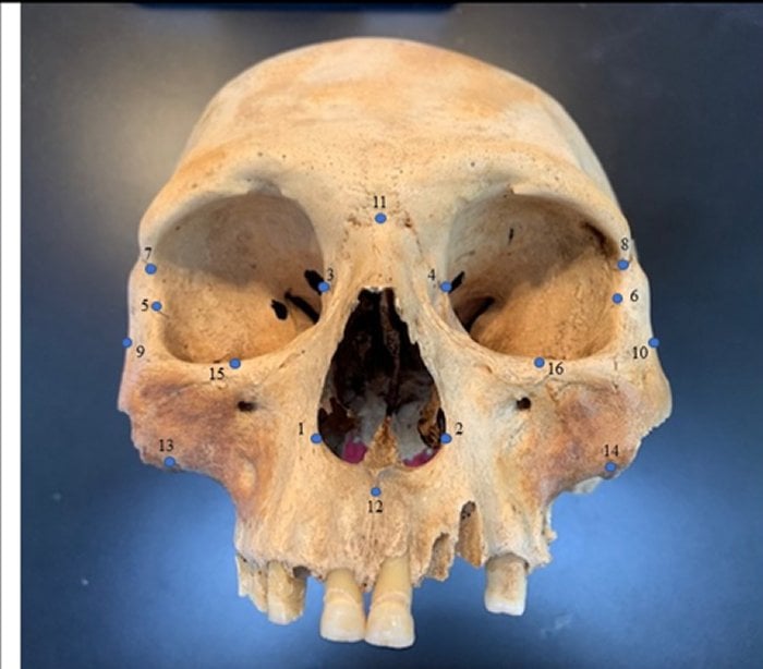 Researchers used 16 facial “landmarks” to analyze skulls, a technique often used as a genetic proxy. Credit: Ann Ross/North Carolina State University