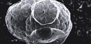 Exotic Life Found Inside Mini Spheroids With Mysterious Dark Cores - Startling Discovery
