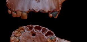 Genetic Evidence Retrieved From 800,000-Year-Old Human Tooth