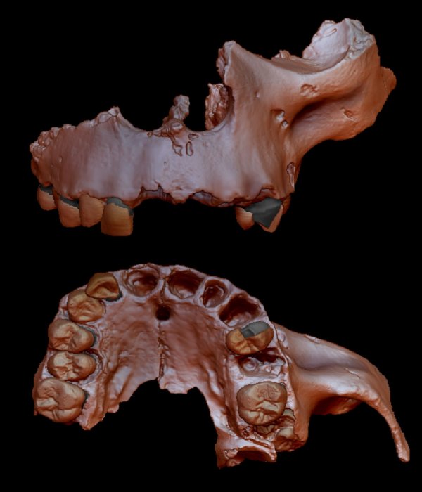 Genetic Evidence Retrieved From 800,000-Year-Old Human Tooth