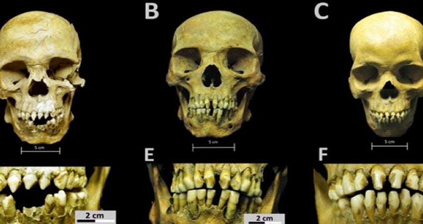 African Skeletons From Early Colonial Mexico And First-Generation Slaves