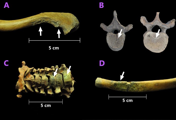 African Skeletons From Early Colonial Mexico And First-Generation Slaves