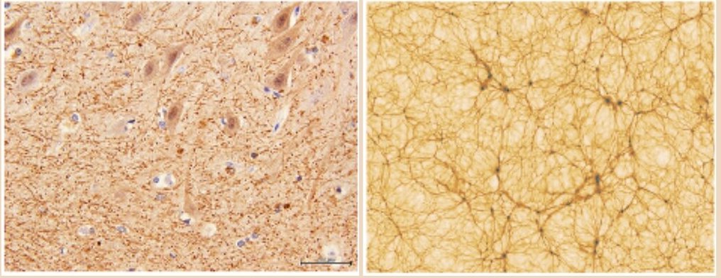 Our Brain Resembles The Universe With Cosmic Network Of Galaxies