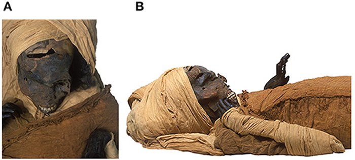 Pharaoh Seqenenre Taa II The Brave Was Brutally Killed By Hyksos Invaders And His Wounds Were Deliberately Concealed - Mummy Scans Reveal