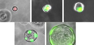 Human ES cell derived RASC (respiratory airway secretory cell) transitioning to an Alveolar type 2 cell over time in culture. Credit: University of Pennsylvania