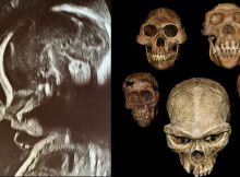A Surprising Relationship Between The Teeth And The Evolution Of Pregnancy - Study