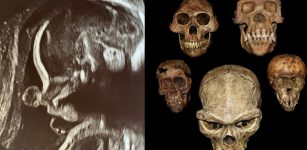 A Surprising Relationship Between The Teeth And The Evolution Of Pregnancy - Study