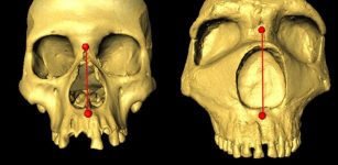Nose Shape Gene Inherited From Neanderthals