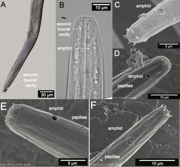 Great Salt Lake's New Species Of Roundworm Gets Shoshone Name